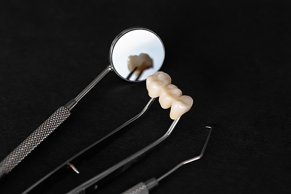 How To Make Your Dental Bridge Last